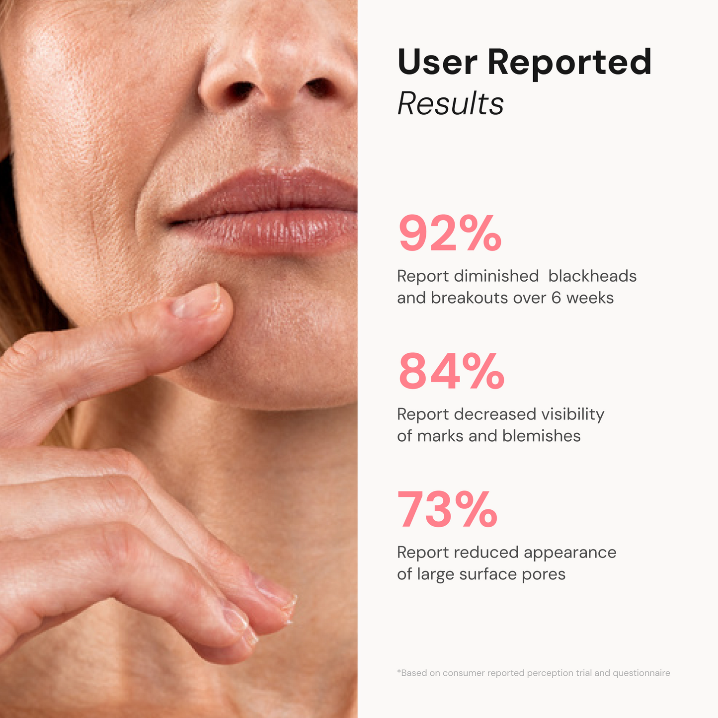 Derma Exfoliator Pro with Active Thermal Pad - BodyVital ∙ Skin and Beauty