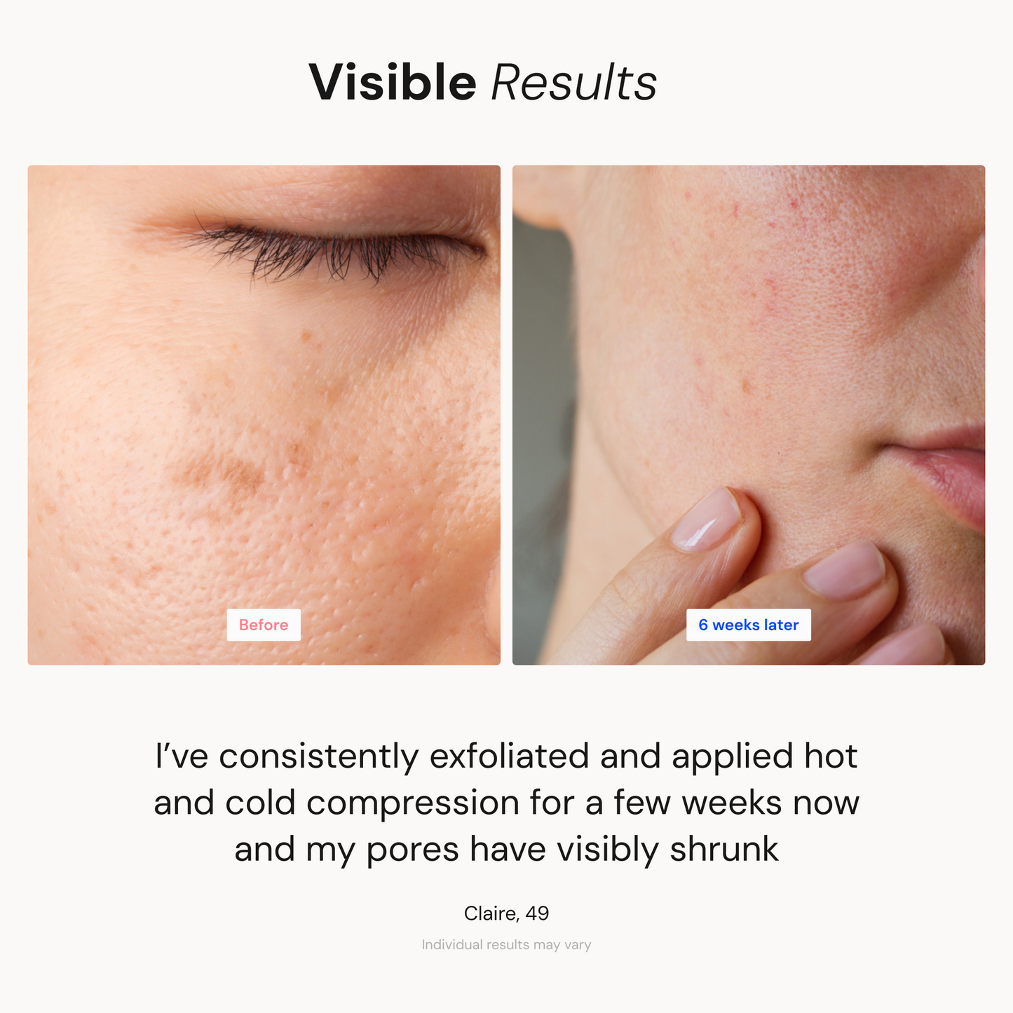 Derma Exfoliator Pro with Active Thermal Pad - BodyVital ∙ Skin and Beauty