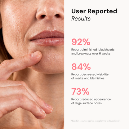 Derma Exfoliator Pro with Active Thermal Pad - BodyVital ∙ Skin and Beauty